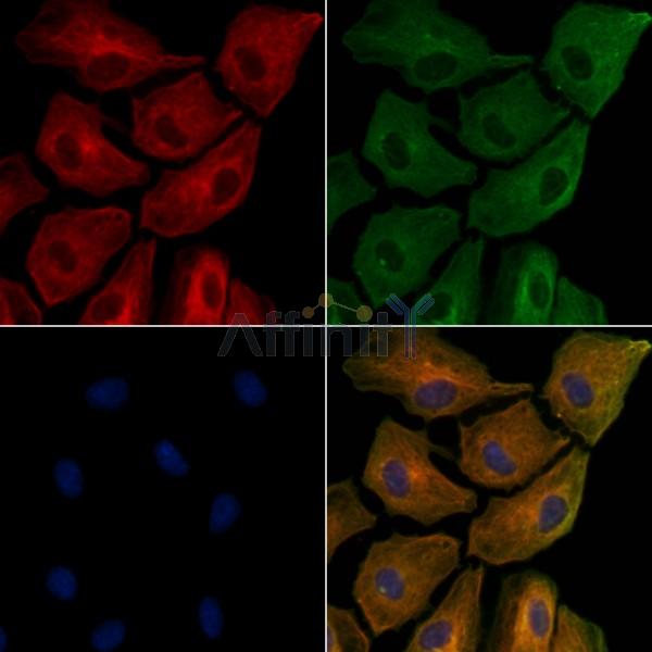 APOC3 Antibody - DF8054 staining A549 cells by IF/ICC.