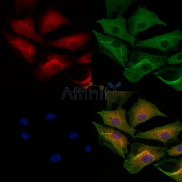 MYBPC3 Antibody - DF8063 staining A549 cells by IF/ICC.