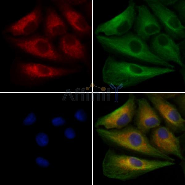 PTP4A2 Antibody - DF8076 staining A549 cells by IF/ICC.