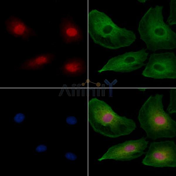 PYGO2 Antibody - DF8107 staining A549 cells by IF/ICC.