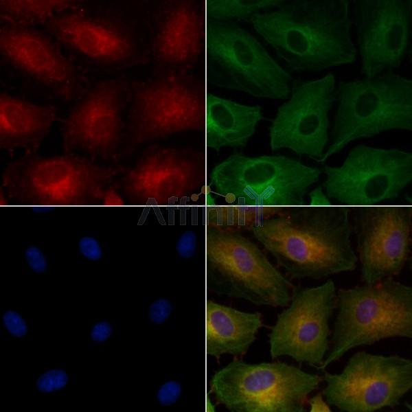 RNLS Antibody - DF8129 staining A549 cells by IF/ICC.