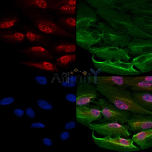 MBD2 Antibody - DF8149 staining A549 cells by IF/ICC.