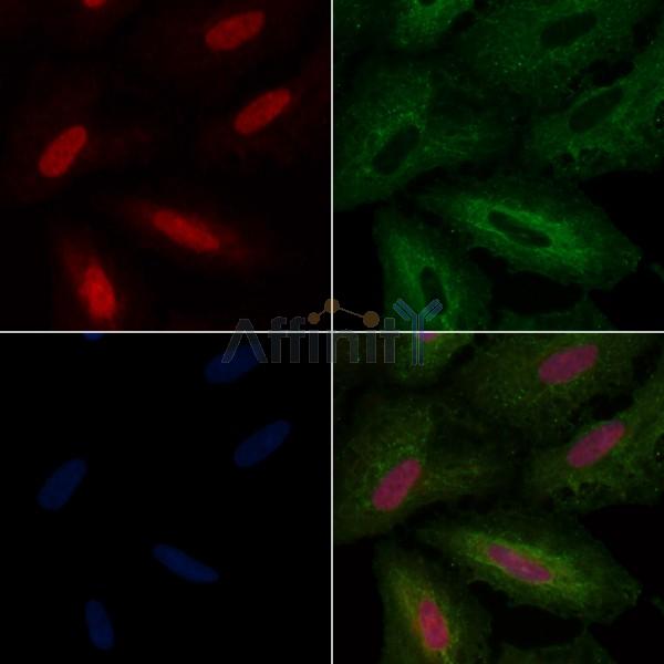 ANKRD20 Antibody - AF9008 staining A549 cells by IF/ICC.