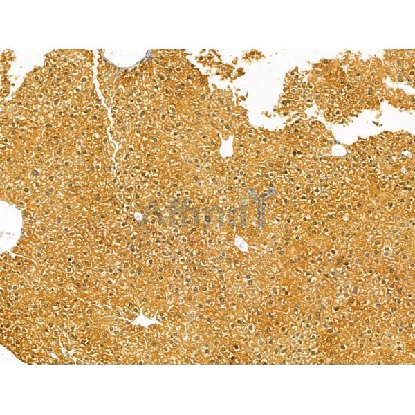 PKLR Antibody - DF12221 at 1/100 staining Mouse liver tissue by IHC-P.