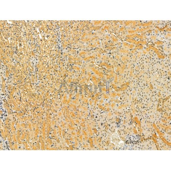 PKLR Antibody - DF12221 at 1/100 staining Mouse kidney tissue by IHC-P.