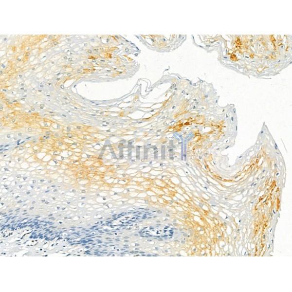 PRSS8 Antibody - DF12224 at 1/100 staining Human normal tissues adjacent to esophageal cancer by IHC-P.
