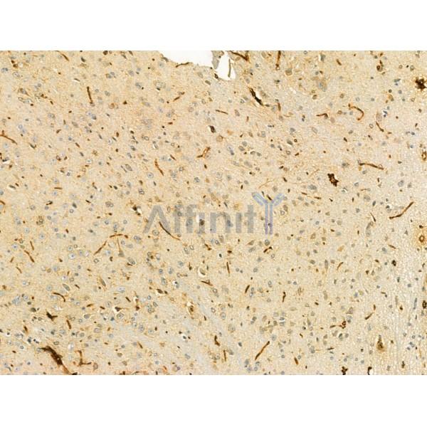 SECISBP2 Antibody - DF12228 at 1/100 staining Mouse brain tissue by IHC-P.