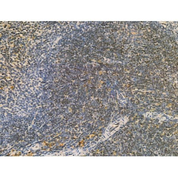 SECISBP2 Antibody - DF12228 at 1/100 staining Mouse spleen tissue by IHC-P.