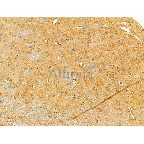 SECISBP2 Antibody - DF12228 at 1/100 staining Rat brain tissue by IHC-P.