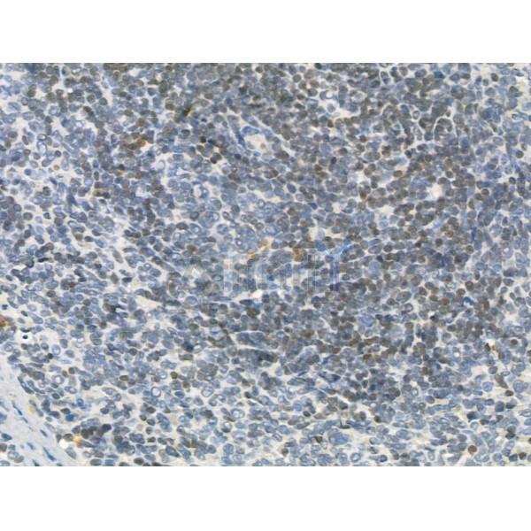 SECISBP2 Antibody - DF12228 at 1/100 staining Rat spleen tissue by IHC-P.