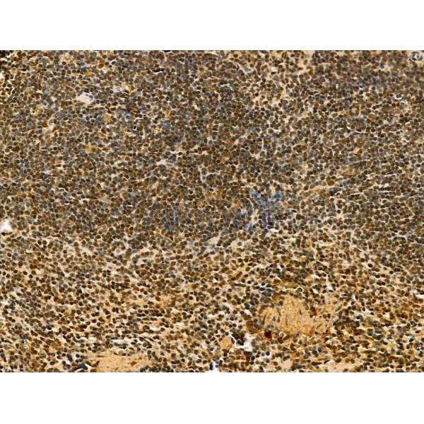 TLE3 Antibody - DF12237 at 1/100 staining Mouse spleen tissue by IHC-P.