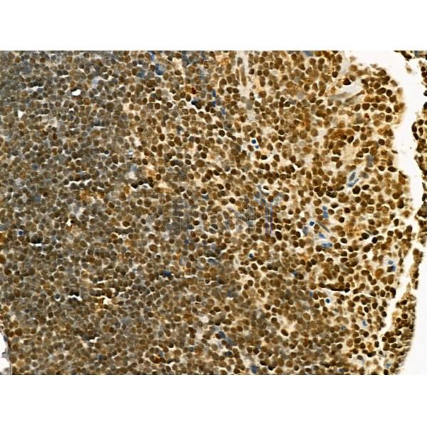 TLE3 Antibody - DF12237 at 1/100 staining Rat thymus tissue by IHC-P.