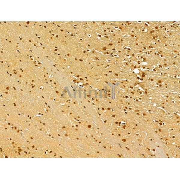 TLE3 Antibody - DF12237 at 1/100 staining Rat brain tissue by IHC-P.