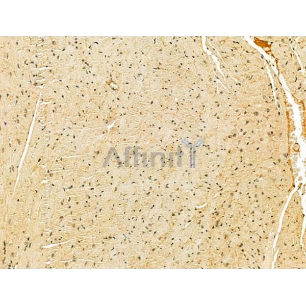 TLE3 Antibody - DF12237 at 1/100 staining Mouse heart tissue by IHC-P.