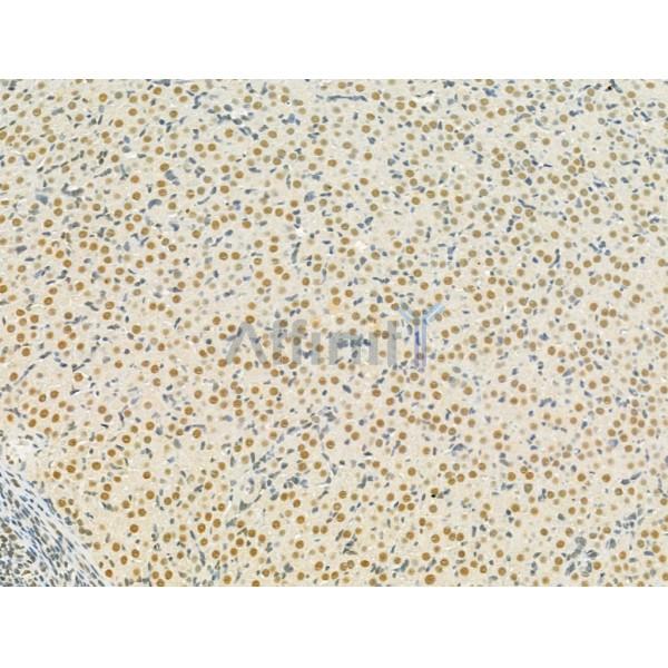 TLE3 Antibody - DF12237 at 1/100 staining Rat ovary tissue by IHC-P.