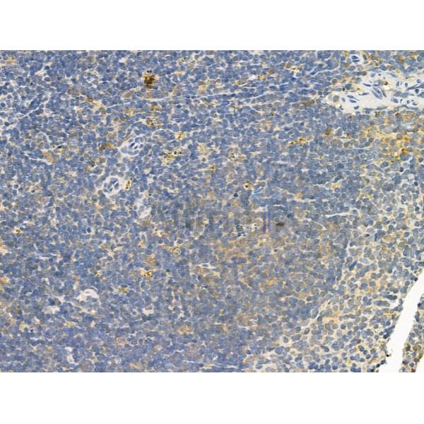 TMOD4 Antibody - DF12238 at 1/100 staining Mouse spleen tissue by IHC-P.