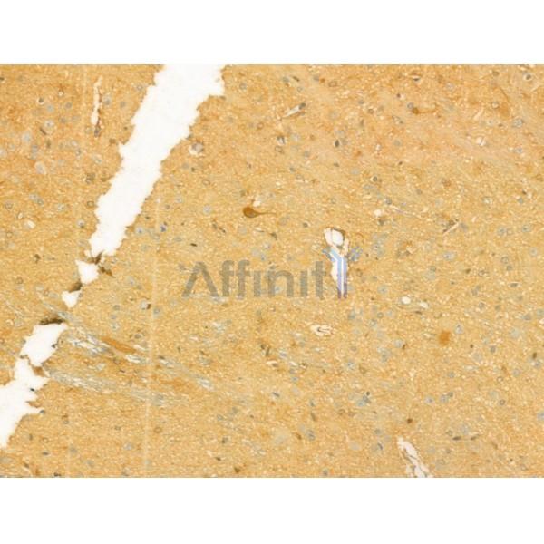 UQCRFS1 Antibody - DF12240 at 1/100 staining Rat brain tissue by IHC-P.