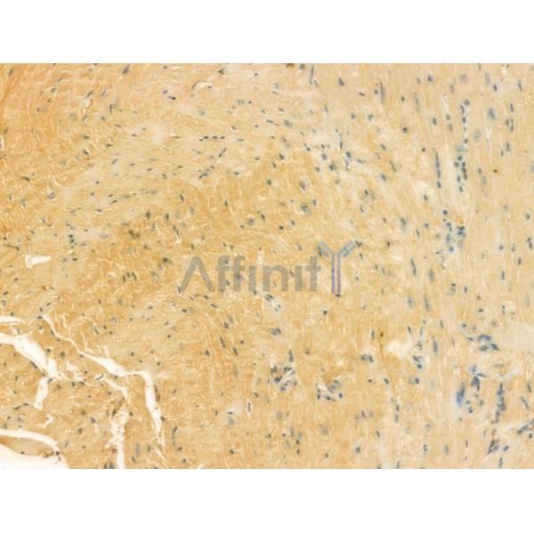 UQCRFS1 Antibody - DF12240 at 1/100 staining Mouse heart tissue by IHC-P.