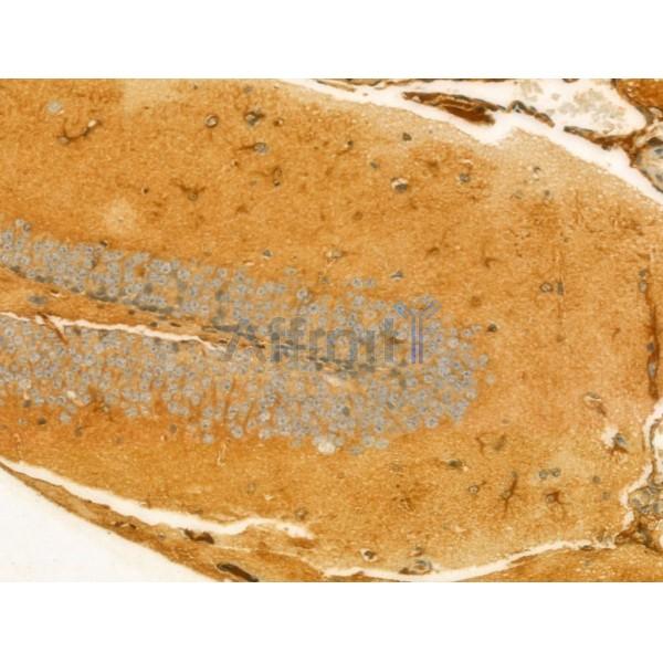 UQCRFS1 Antibody - DF12240 at 1/100 staining Mouse brain tissue by IHC-P.