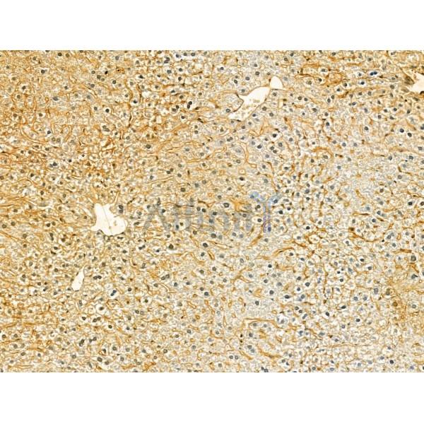 VPS16 Antibody - DF12242 at 1/100 staining Mouse liver tissue by IHC-P.
