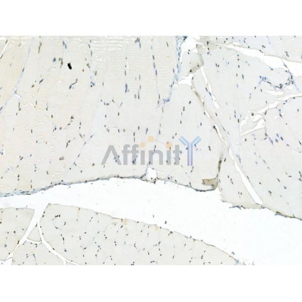 AEBP2 Antibody - DF12245 at 1/100 staining Rat muscle tissue by IHC-P.