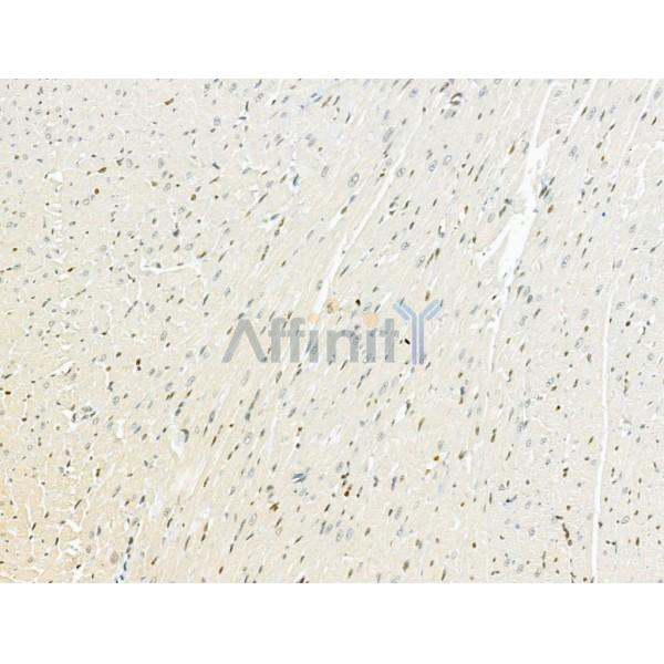 AEBP2 Antibody - DF12245 at 1/100 staining Rat heart tissue by IHC-P.