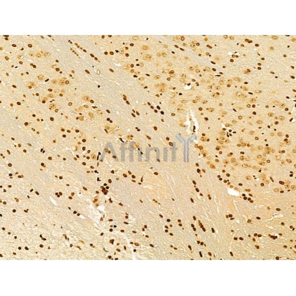 AEBP2 Antibody - DF12245 at 1/100 staining Rat brain tissue by IHC-P.