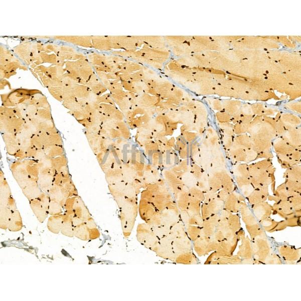 AEBP2 Antibody - DF12245 at 1/100 staining Rat skin tissue by IHC-P.