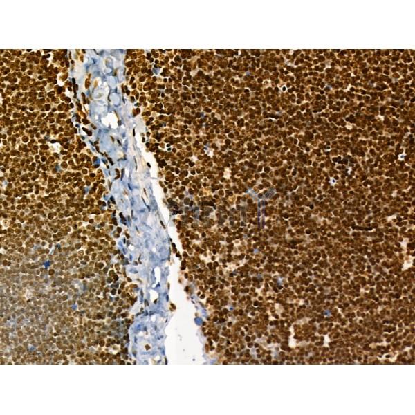 AEBP2 Antibody - DF12245 at 1/100 staining Rat thymus tissue by IHC-P.