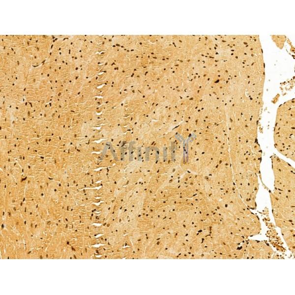 AEBP2 Antibody - DF12245 at 1/100 staining Mouse heart tissue by IHC-P.