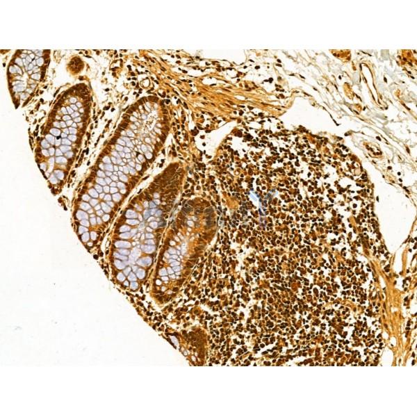 AEBP2 Antibody - DF12245 at 1/100 staining Human normal tissues adjacent to colorectal cancer by IHC-P.