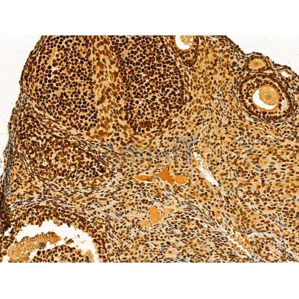 AEBP2 Antibody - DF12245 at 1/100 staining Mouse ovary tissue by IHC-P.