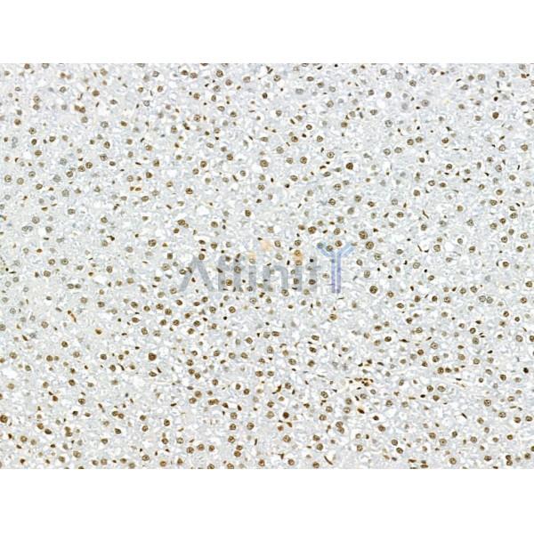 AEBP2 Antibody - DF12245 at 1/100 staining Rat liver tissue by IHC-P.
