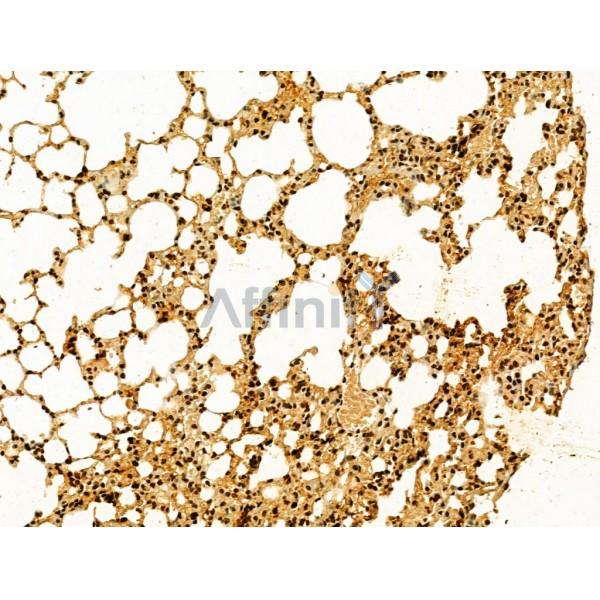 AEBP2 Antibody - DF12245 at 1/100 staining Mouse lung tissue by IHC-P.