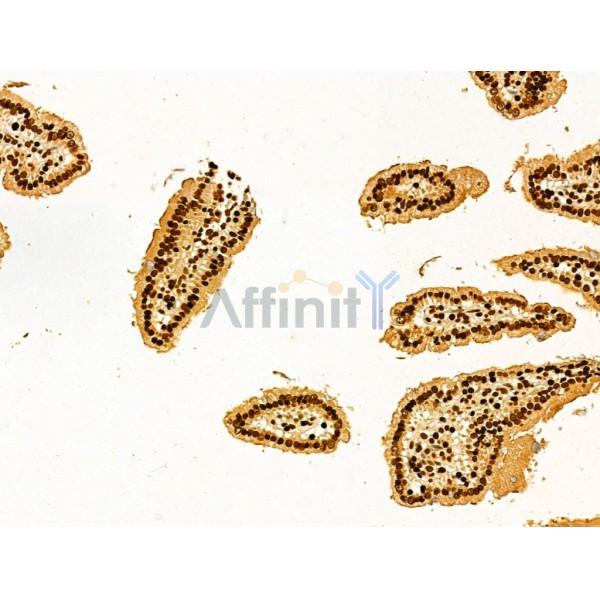 AEBP2 Antibody - DF12245 at 1/100 staining Mouse colon tissue by IHC-P.
