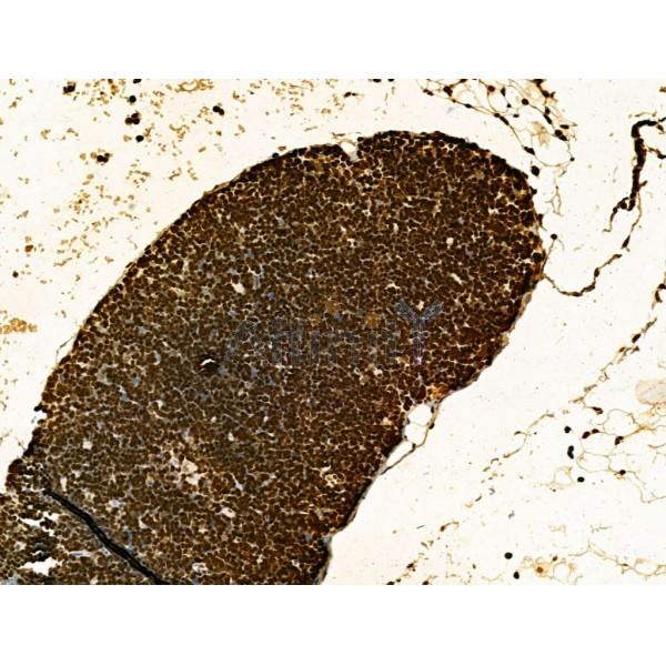 AEBP2 Antibody - DF12245 at 1/100 staining Mouse thymus tissue by IHC-P.