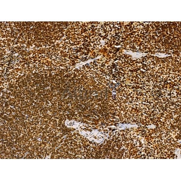 AEBP2 Antibody - DF12245 at 1/100 staining Mouse spleen tissue by IHC-P.