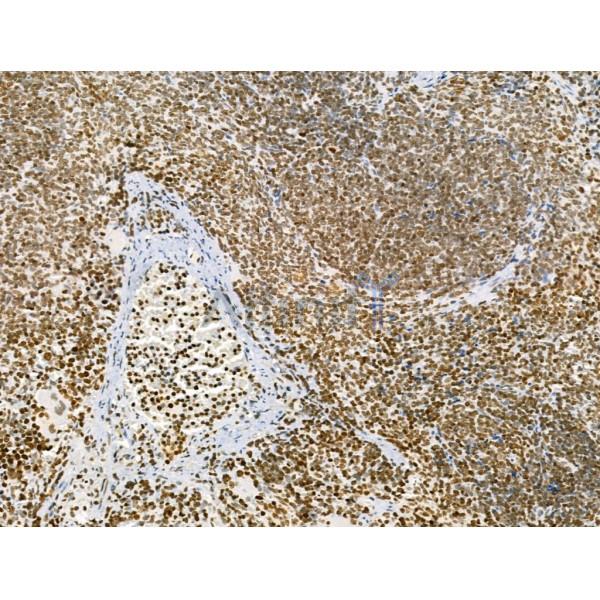 AEBP2 Antibody - DF12245 at 1/100 staining Rat spleen tissue by IHC-P.