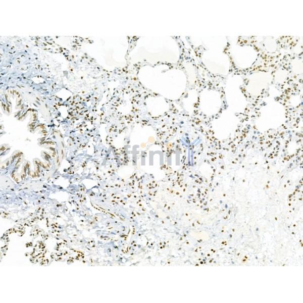 AEBP2 Antibody - DF12245 at 1/100 staining Rat lung tissue by IHC-P.