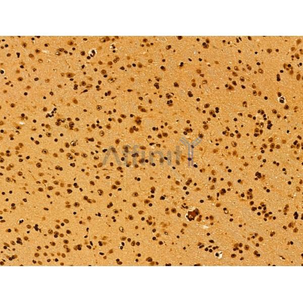 AEBP2 Antibody - DF12245 at 1/100 staining Mouse brain tissue by IHC-P.