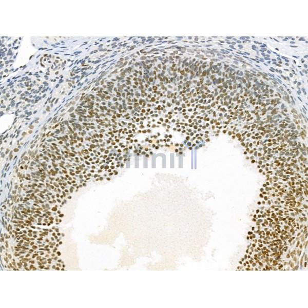 AEBP2 Antibody - DF12245 at 1/100 staining Rat ovary tissue by IHC-P.
