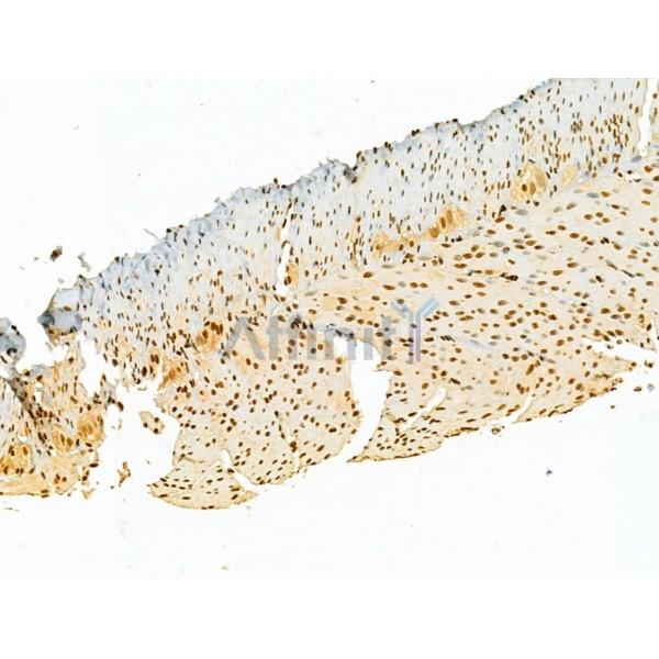 AEBP2 Antibody - DF12245 at 1/100 staining Rat stomach tissue by IHC-P.