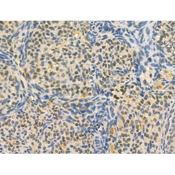 OBFC2B Antibody - DF13202 at 1/100 staining Mouse ovary tissue by IHC-P.