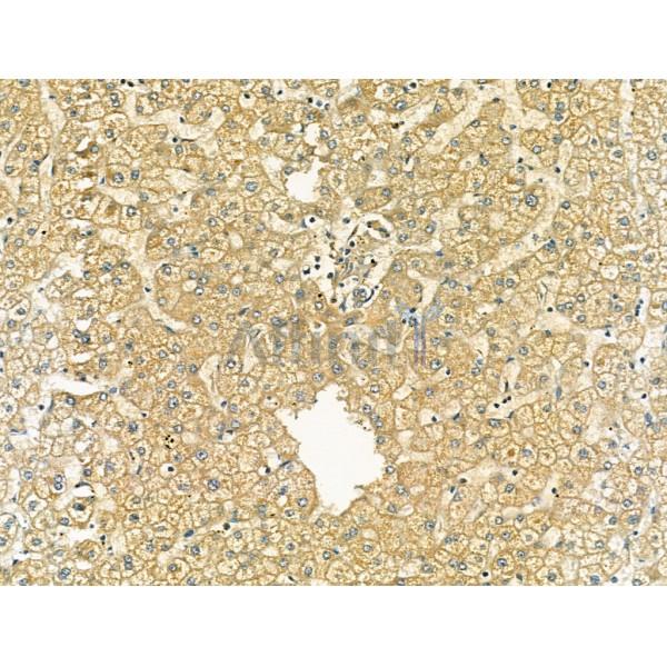 OCIAD1 Antibody - DF13203 at 1/100 staining Human normal tissues adjacent to liver cancer by IHC-P.