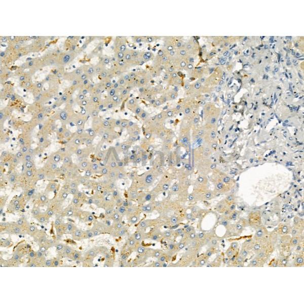 ODAM Antibody - DF13204 at 1/100 staining Human normal tissues adjacent to liver cancer by IHC-P.