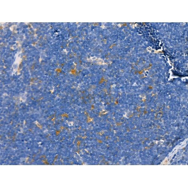 ODZ1 Antibody - DF13206 at 1/100 staining Rat thymus tissue by IHC-P.