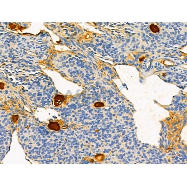 OFD1 Antibody - DF13207 at 1/100 staining Mouse ovary tissue by IHC-P.