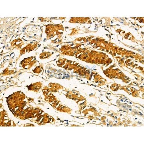 OFD1 Antibody - DF13207 at 1/100 staining Human normal tissues adjacent to gastric cancer by IHC-P.