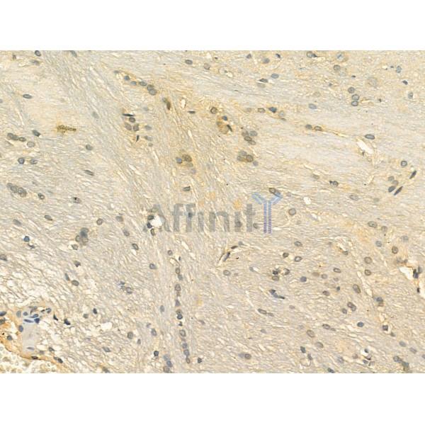 OFD1 Antibody - DF13207 at 1/100 staining Rat brain tissue by IHC-P.
