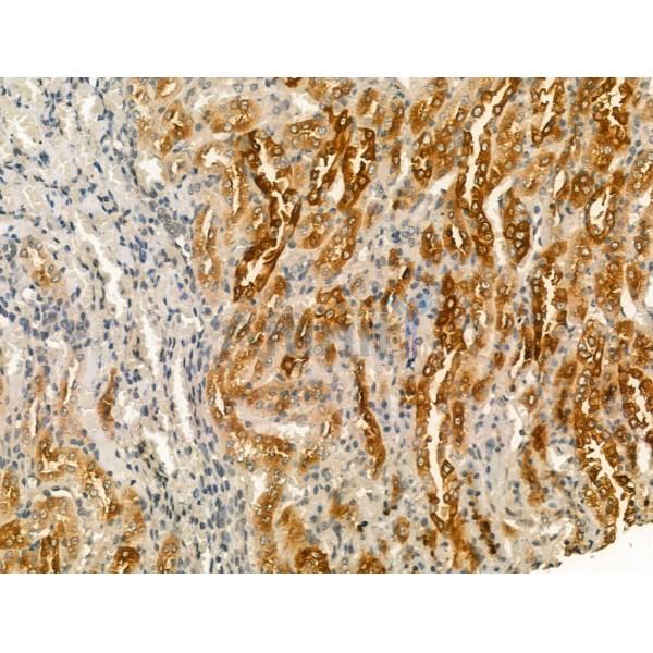 Pericentrin - Centrosome Marker Antibody - DF13210 at 1/100 staining Rat kidney tissue by IHC-P.